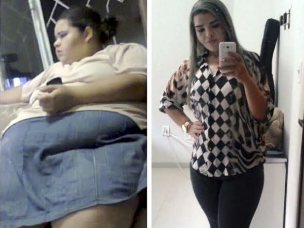 Paula perdeu 98 kg e mudou de vida aps passar pela reduo de estmago