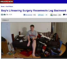 Cirurgia reimplanta ao contrrio perna de menino nos Estados Unidos
