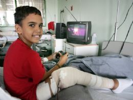 Agora quero ser feliz, diz menino de 11 anos que teve perna reimplantada