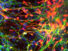 Cientistas criam clulas-tronco neurais a partir de embrionrias