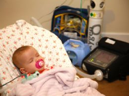 Beb inglesa depende de aparelho para respirar enquanto dorme