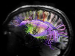 Imagem revela como o crebro  organizado