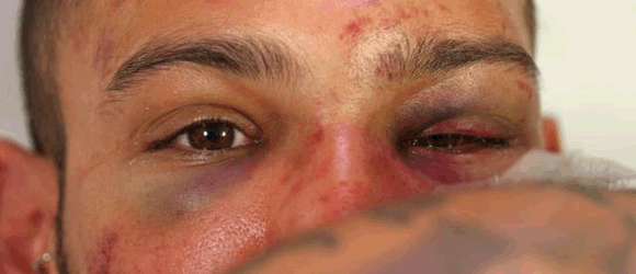 Vtor teve fraturas no rosto e permanece internado numa clnica na Ilha do Governador:
