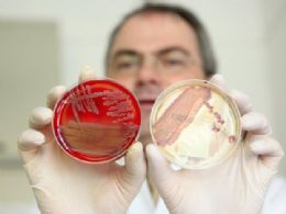 OMS diz que bactria 'E. coli' pode ser passada de pessoa para pessoa