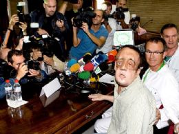 Homem aparece em pblico aps transplante de rosto na Espanha