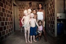 Rosemere, me de cinco filhos, sendo trs albinos, posa na frente de sua casa, na periferia de Olinda (PE), em 30 de agosto deste ano