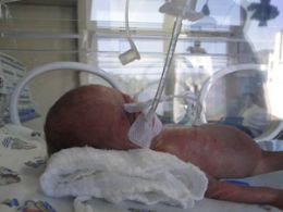 Hospital prepara alta de beb que nasceu com 620 g em Santa Catarina