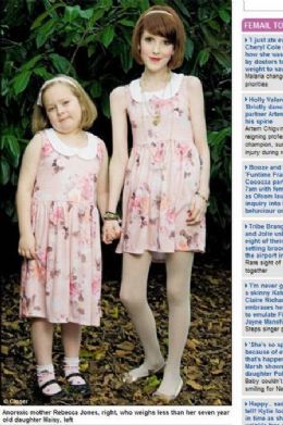 Inglesa anorxica de 26 anos pesa menos que a filha de sete anos