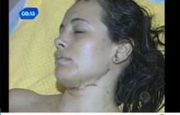Mulher sobrevive aps ser golpeada com 39 facadas de seu ex-namorado