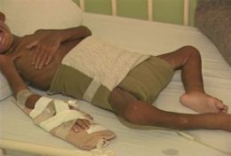 Mortalidade infantil em aldeias de Dourados  maior que mdia nacional