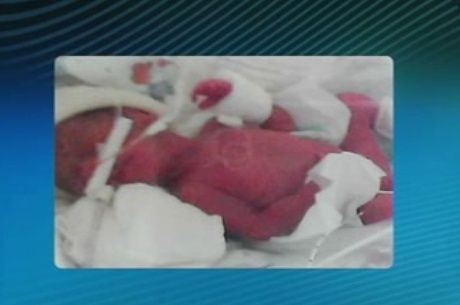 Recm-nascido dado como morto volta a respirar aps cinco horas em necrotrio