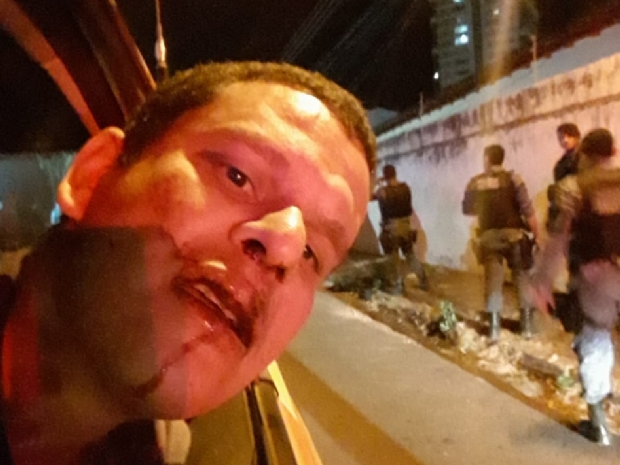 Cabo denuncia agresso por policiais militares em Cuiab