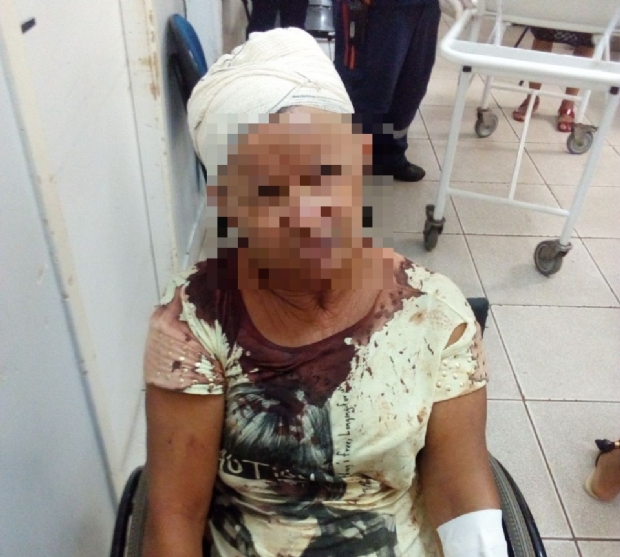 Mulher  atropelada e espancada por criminoso em Vrzea Grande