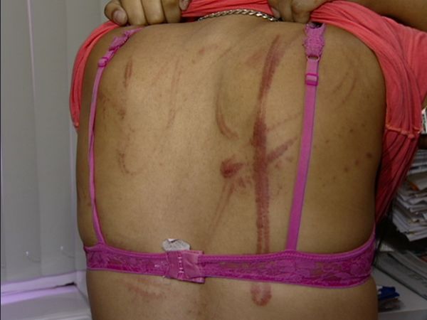 Adolescente foi agredita pelo namorado, segundo a polcia, em Vitria