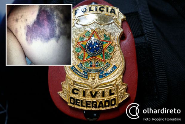 Delegado  acusado de agredir esposa advogada em Mato Grosso