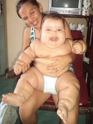 'Mdica passou uma dieta', diz me de beb de 8 meses que pesa 18 quilos
