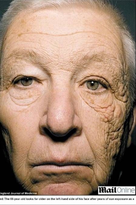 Homem expe metade do rosto ao sol por 28 anos e fica mais 