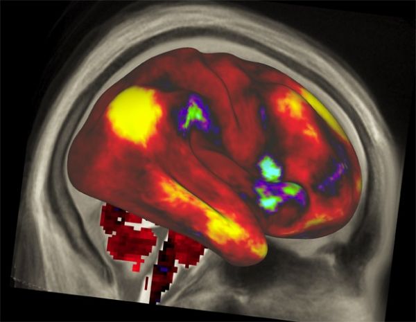 Pesquisadores divulgam imagens de grande definio do crebro humano