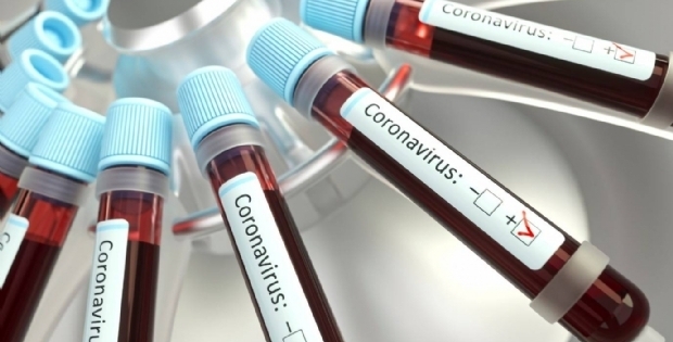 Governo ainda aguarda 23 testes de pacientes suspeitos de infeco pelo coronavrus