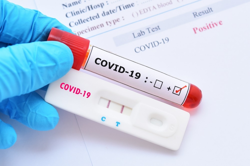 Com surto de gripe e Covid-19, Cuiab registra mais de 200 afastamentos dos servidores da Sade que contraram doenas