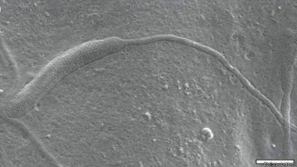 Acredita-se que espermatozide seja o mais antigo j encontrado