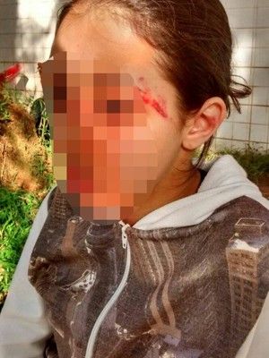 Jovem fica ferida aps agresso em escola estadual