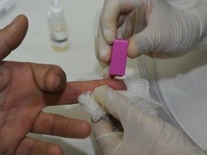 Nova doena tem sintomas parecidos com o da Aids, aponta estudo na sia