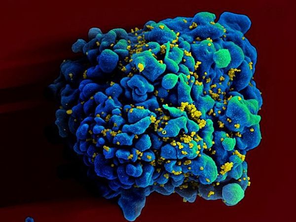 Vrus 'primo' do HIV  suprimido em estudos com macacos nos EUA