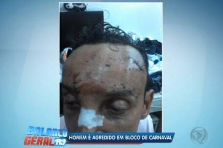 Homem foi agredido durante bloco de carnaval