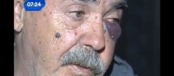 Idoso foi agredido com a prpria bengala em um supermercado do Rio Grande do Sul