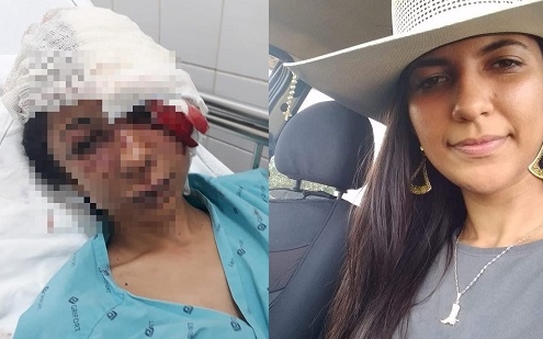 Jovem que espancou e desfigurou rosto de namorada  preso em Mato Grosso