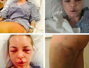 J no hospital, Christy Mack postou fotos do seu estado aps sofrer as agresses