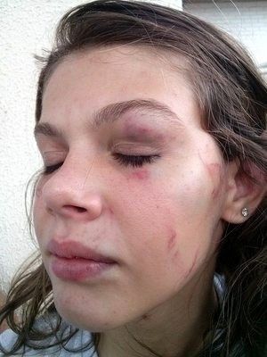 Garota  espancada dentro de escola por ser bonita, afirma pai