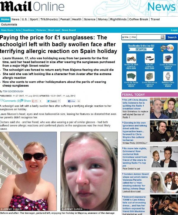 Britnica compra culos de sol por R$ 2,50 e tem reao alrgica grave