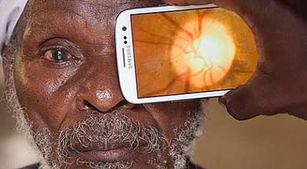 App transforma celular em 'oftalmologista porttil'