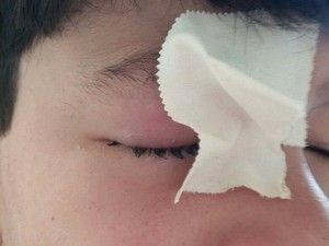 Menino sofre leso no olho durante show de mgico