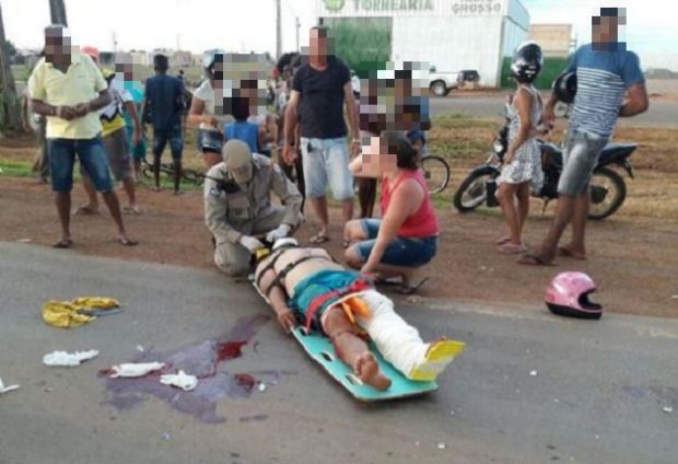 Motociclista sofre fratura exposta aps colidir com outra moto em rodovia