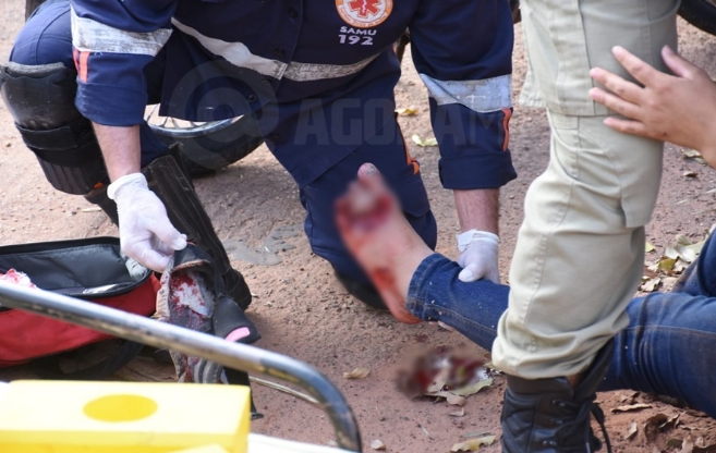 Mulher tem p dilacerado durante batida entre motocicletas em cruzamento