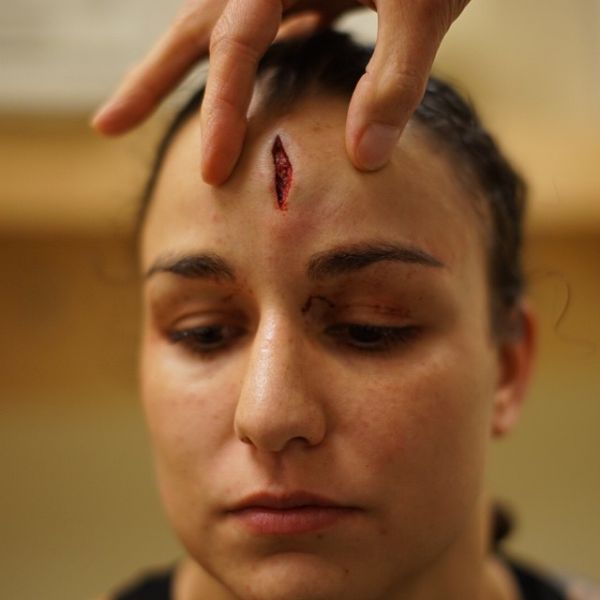 Raquel Pennington mostra corte profundo na testa aps vitria no UFC 181