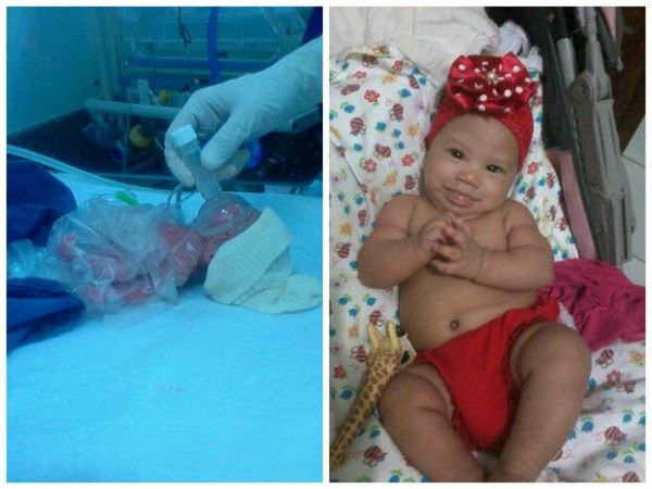 Rayssa Vitria nasceu prematura com 620 grama. Aps oito meses e em casa, ela est com mais de 6 kg