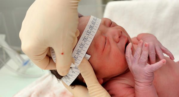 Recm-nascido tem a cabea medida para verificar microcefalia