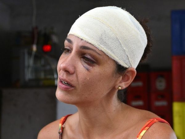 Mulher  agredida com remo pelo marido: 'quem bate no tem amor'