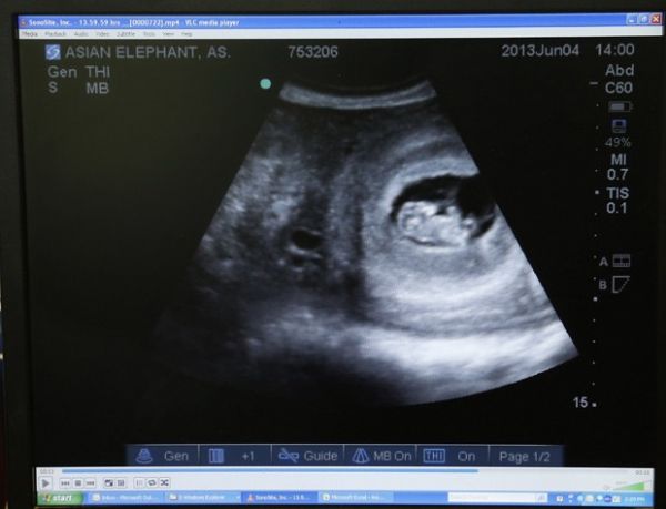 Zoo anuncia gravidez de elefanta e mostra imagens de ultrassom