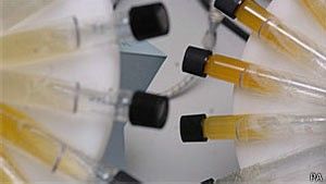 Cientistas criam teste que detecta cncer de bexiga em 'odor' de urina