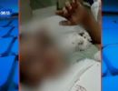 Menino de dois anos  atacado por macaco em zoolgico